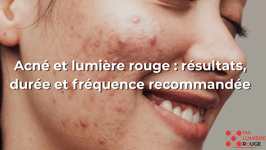 Acné et lumière rouge : résultats, durée et fréquence recommandée