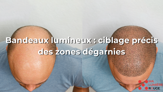 Bandeaux lumineux : ciblage précis des zones dégarnies