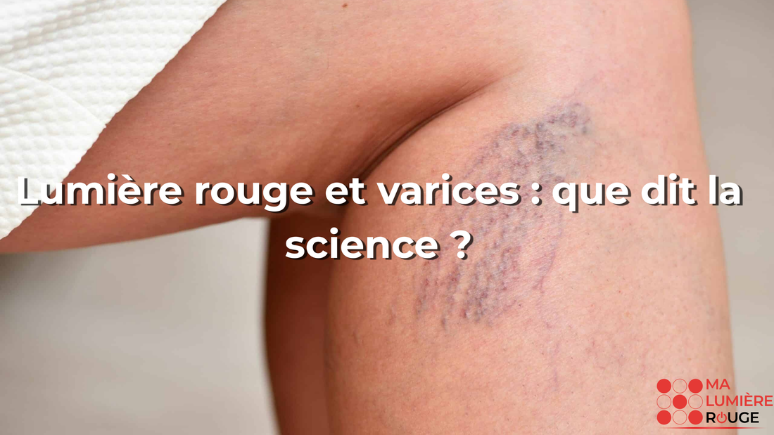 Lumière rouge et varices : que dit la science ?