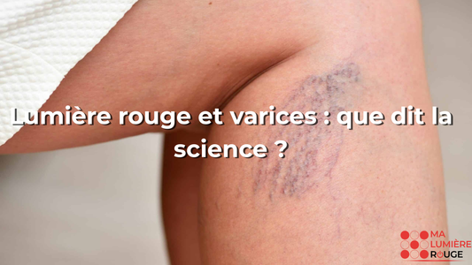 Lumière rouge et varices : que dit la science ?