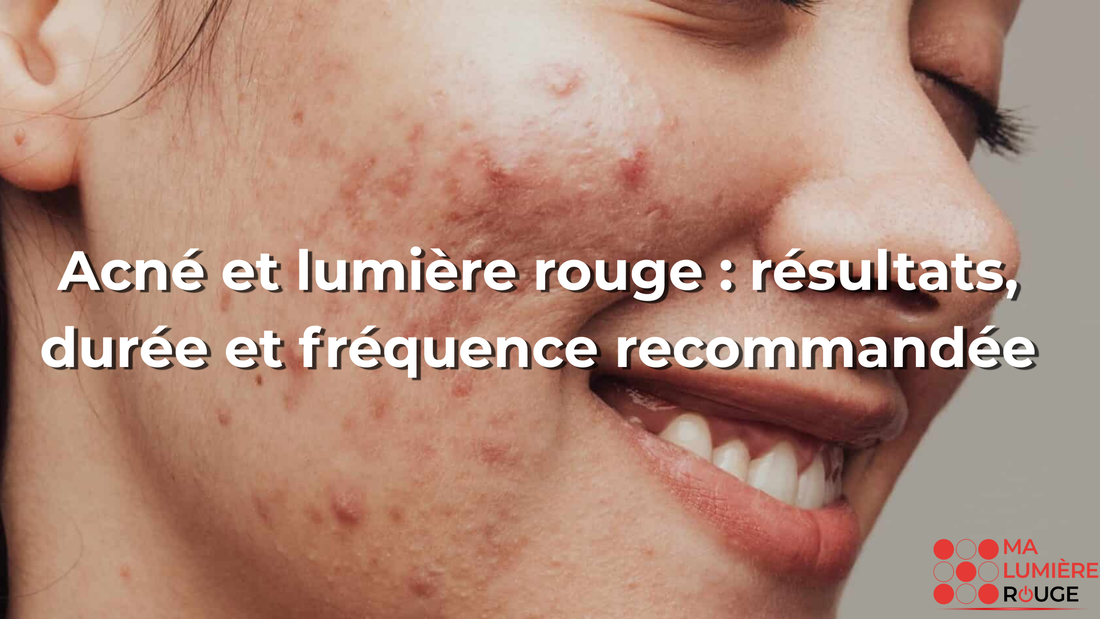 Acné et lumière rouge : résultats, durée et fréquence recommandée