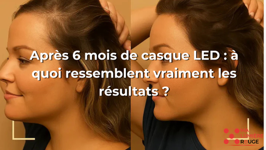 Après 6 mois de casque LED : à quoi ressemblent vraiment les résultats ?