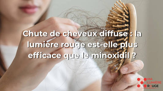 Chute de cheveux diffuse : la lumière rouge est-elle plus efficace que le minoxidil ?