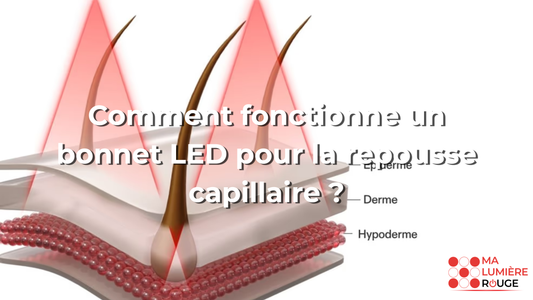 Comment fonctionne un bonnet LED pour la repousse capillaire ?