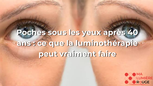Poches sous les yeux après 40 ans : ce que la luminothérapie peut vraiment faire