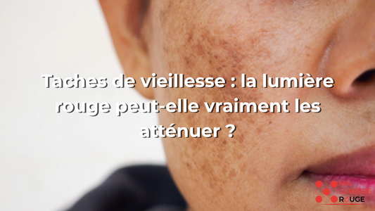 Taches de vieillesse : la lumière rouge peut-elle vraiment les atténuer ?