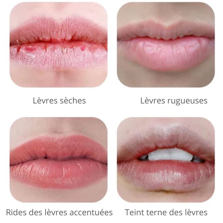 Appareil de Luminothérapie Bucale: Blanchiment Dentaire et Rajeunissement des Lèvres - Ma Lumière Rouge®