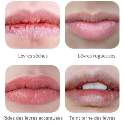 Appareil de Luminothérapie Bucale: Blanchiment Dentaire et Rajeunissement des Lèvres - Ma Lumière Rouge®